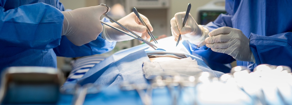 Mesh Removal After Hernia Surgery